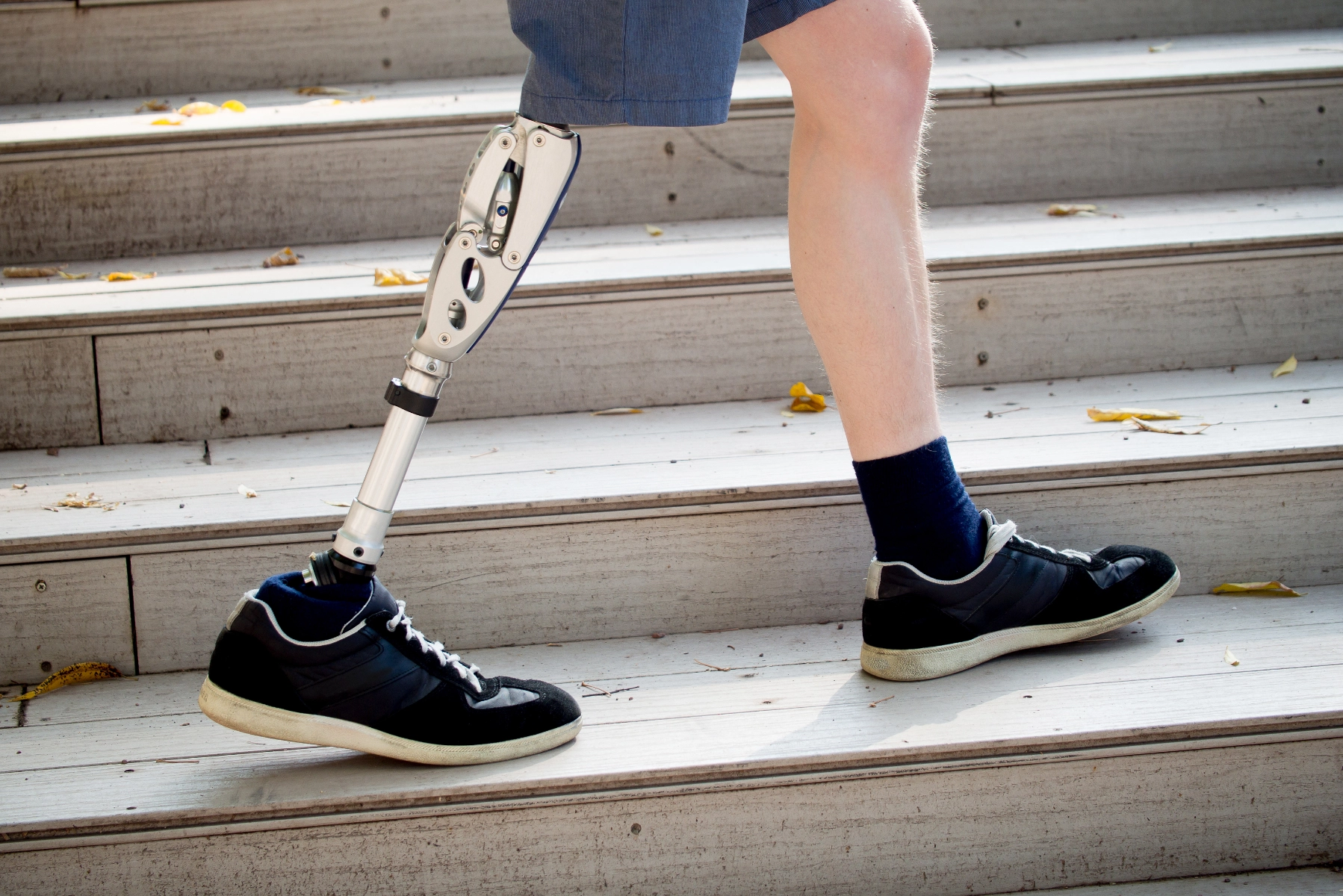 Prosthetics & Orthotics