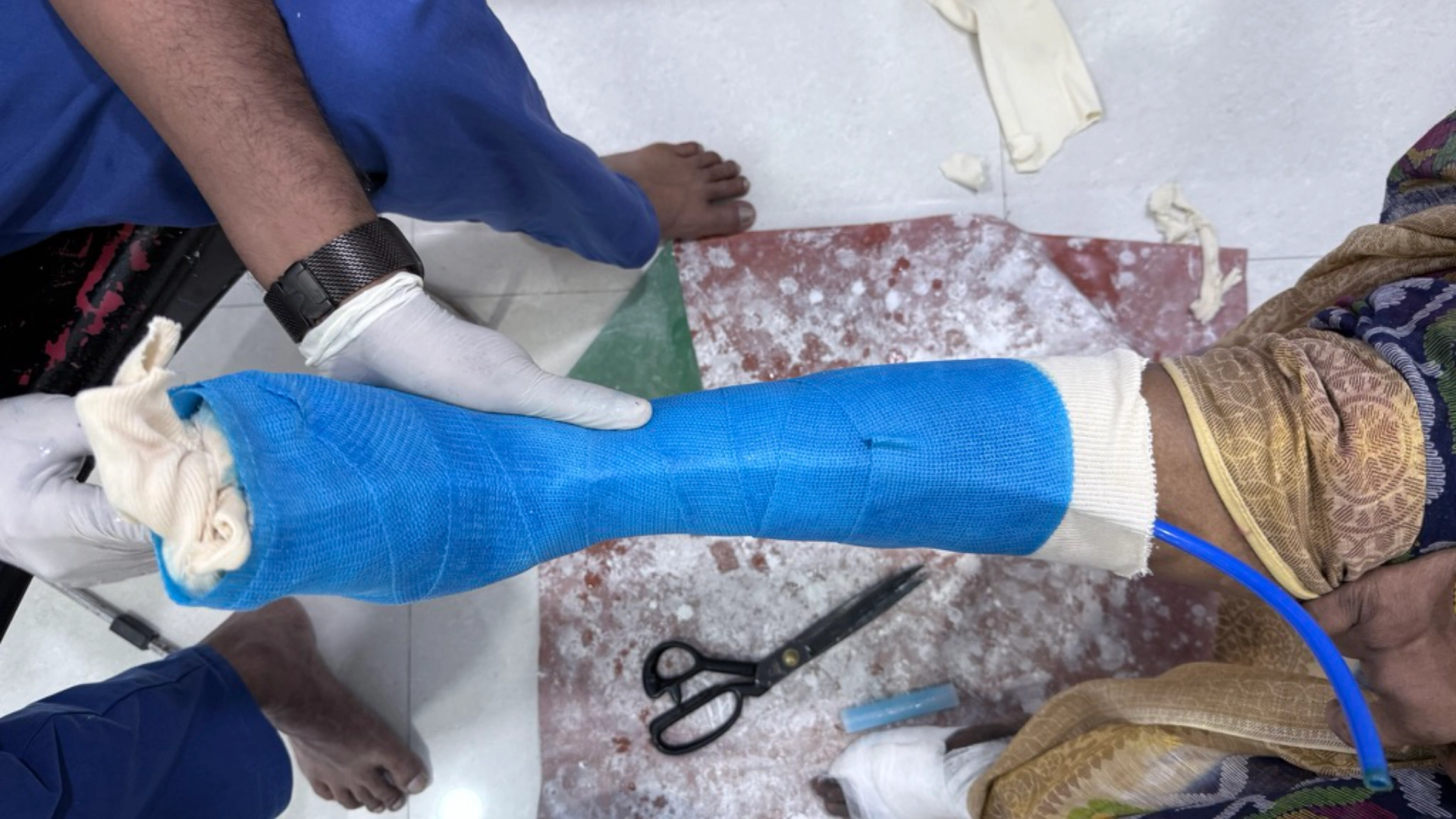 Diabetic Foot Care Physiotherapy